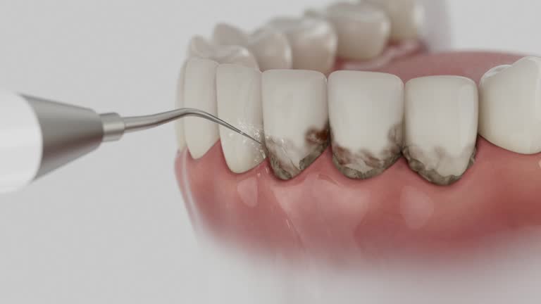 Reliable Dental contractor in Osceola Mills, PA by Dentist Open Now